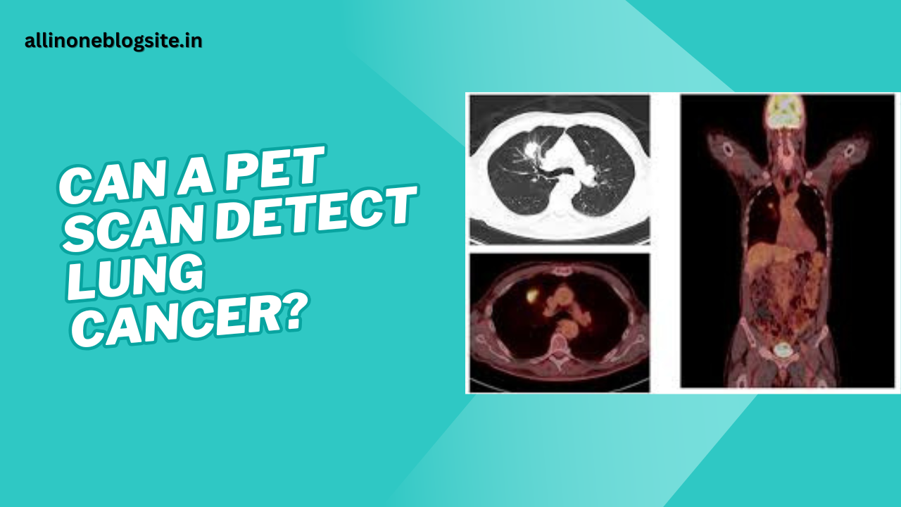 can a pet scan detect lung cancer